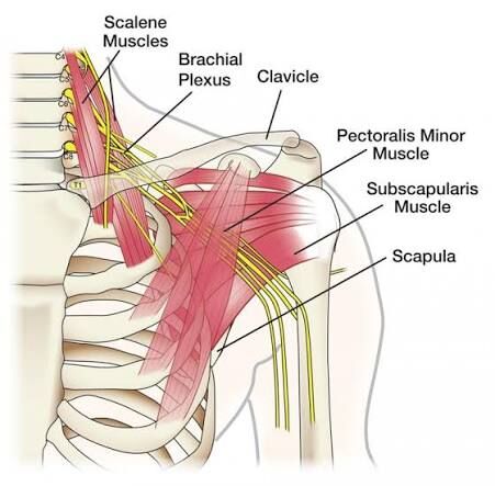 Gurgaon, Businesses For Sale, Brachial Plexus Injury Treatment In Gurgaon | Expert Physiotherapy & Nerve Rehabilitation