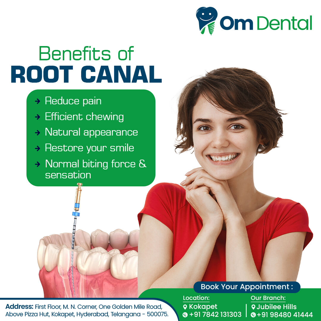 Hyderabad, Dental, Dental Implant Clinic In Jubilee Hills