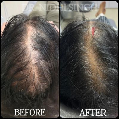 Kolkata, General, Your Trusted Aesthetic Experts In Rajarhat