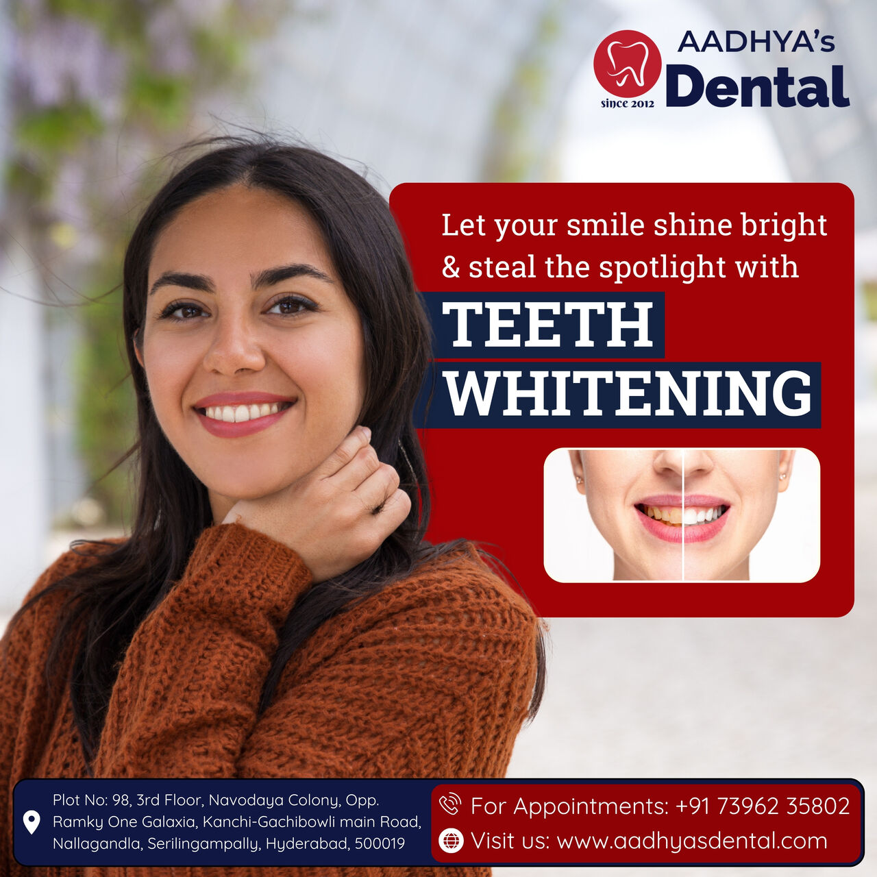 Hyderabad, Dental, Invisalign Treatment In Nallagandla