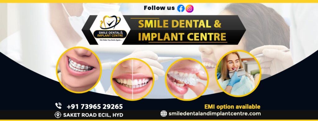 Hyderabad, Dental, Looking For The Best Dental Hospital In AS Rao Nagar? 🦷✨