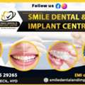 Looking For The Best Dental Hospital In AS Rao Nagar? 🦷✨