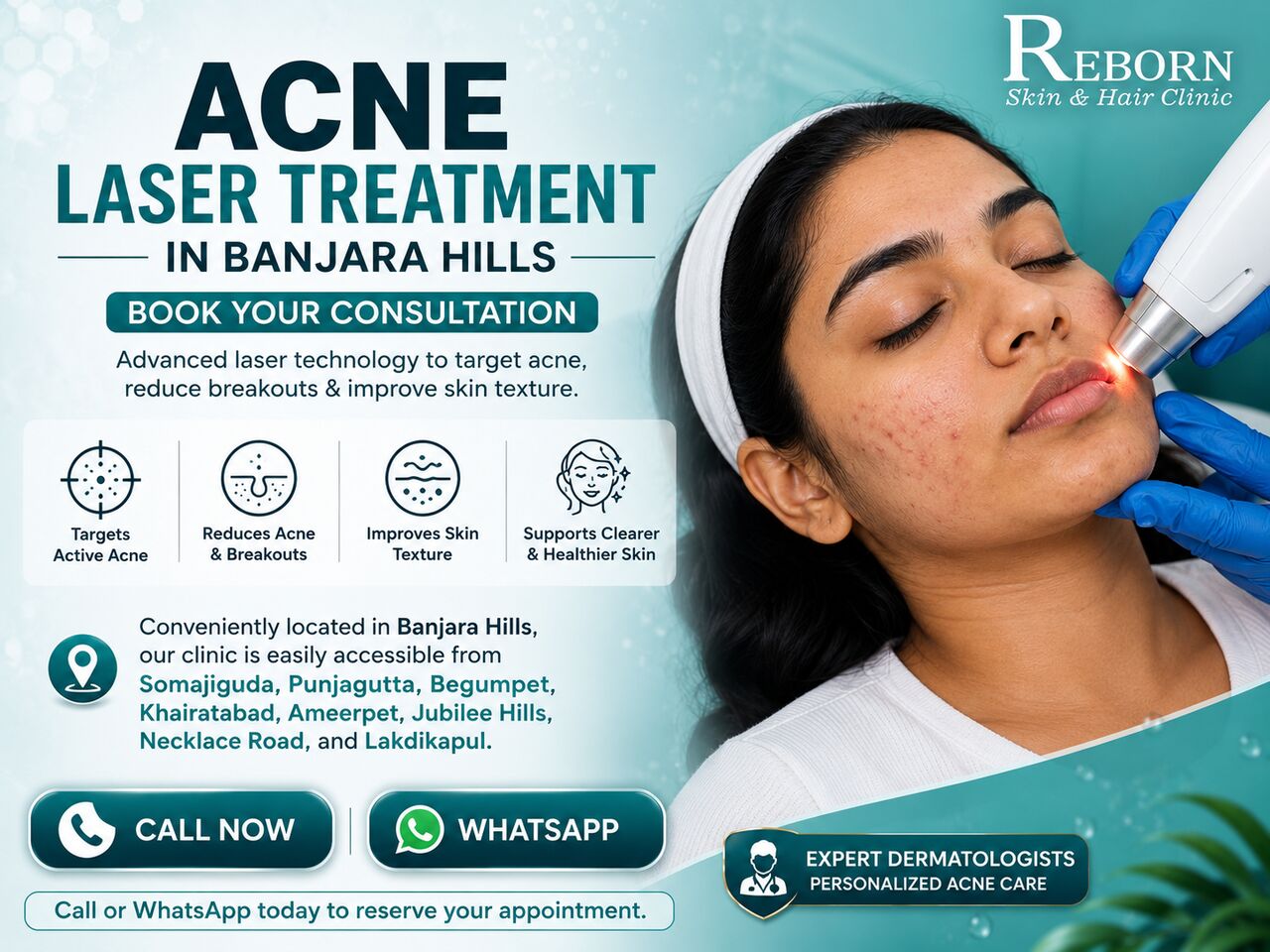 Hyderabad, Health & Beauty Items, INR 3500,  Acne Laser Therapy In Banjara Hills