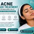 INR 3500,  Acne Laser Therapy In Banjara Hills
