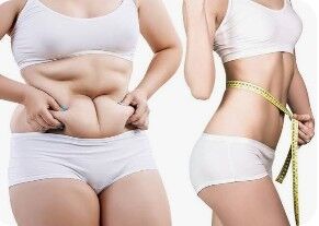 Gurgaon, Health, Tummy Tuck Surgery Near DLF Phase Area, Gurgaon