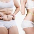 Tummy Tuck Surgery Near DLF Phase Area, Gurgaon