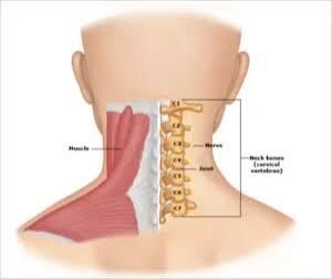 Gurgaon, Businesses For Sale, Cervical Spondylosis Treatment In Gurgaon | Expert Neck Pain & Spine Physiotherapy