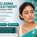 INR 3999,  Melasma & Pigmentation Treatment In Banjara Hills