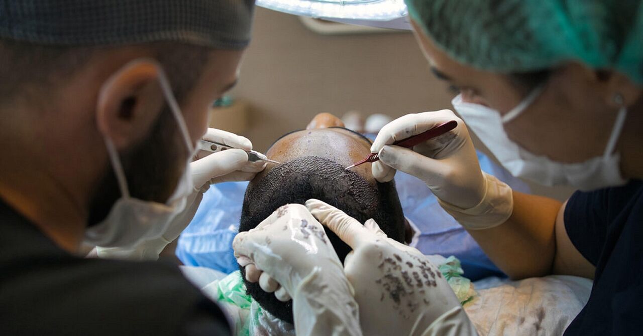 New Delhi, Health & Beauty Items, INR 50,  Get Exceptional Results With The Best Hair Transplant Surgeon In Delhi!