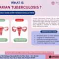 Expert Ovarian TB Care By The Best Gynecologist In Gaur City