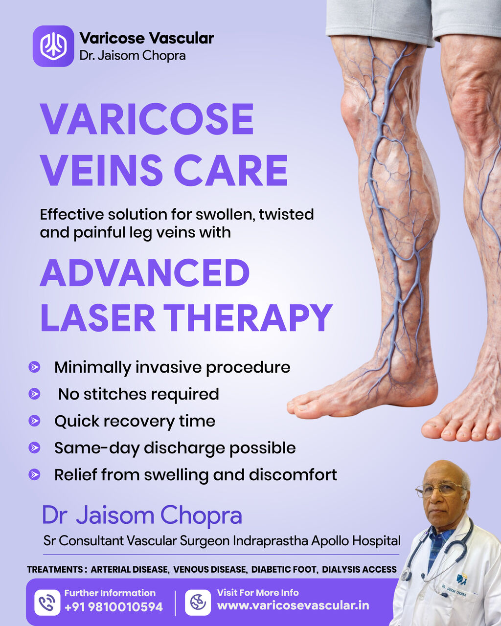 Mumbai, Health, Best Varicose Veins Treatment Clinic In India | Advanced Vascular Care &ndash; Varicose Vascular
