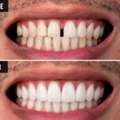 Expert Dental Solutions For Every Smile At AB Dentologic