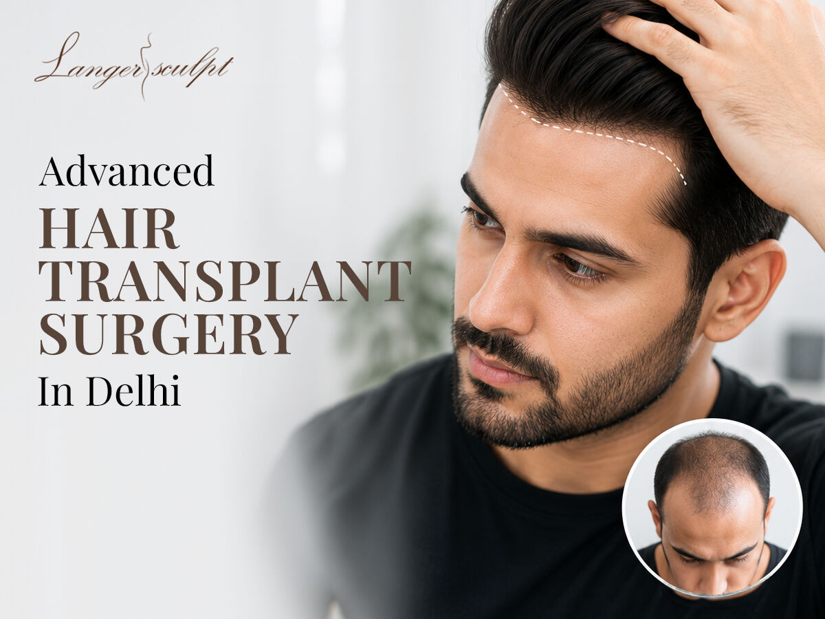 New Delhi, Medical, Get Hair Transplant In Delhi At Langersculpt Clinic