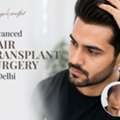 Get Hair Transplant In Delhi At Langersculpt Clinic