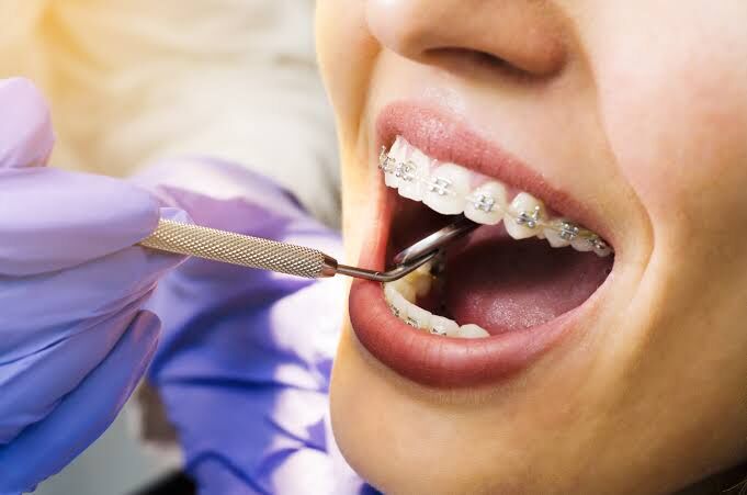 Brampton, Dental, Orthodontic Treatment In Brampton | Sharing Smiles Dental Care