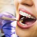 Orthodontic Treatment In Brampton | Sharing Smiles Dental Care