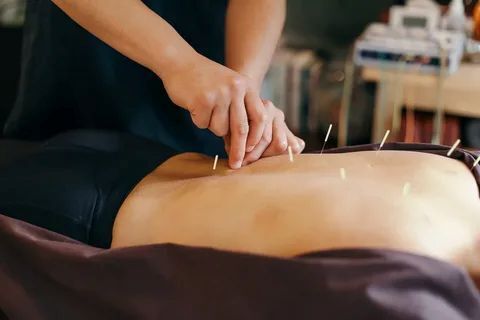New York, Health, Personalized Acupuncture Care In Tucson AZ