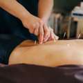 Personalized Acupuncture Care In Tucson AZ