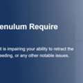 Expert Short Frenulum Treatment In London For Lasting Relief