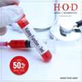 INR 499,  KFT Testing For People With Diabetes And Hypertension