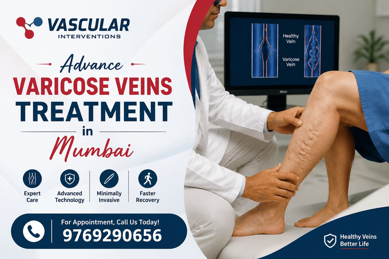 Mumbai, Health, Regain Comfort With Modern Varicose Vein Treatment