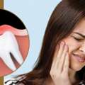 Wisdom Tooth Pain Relief: What Actually Works Before You See A Dentist