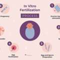 IVF Treatment In Delhi - Dr Rhythm Gupta