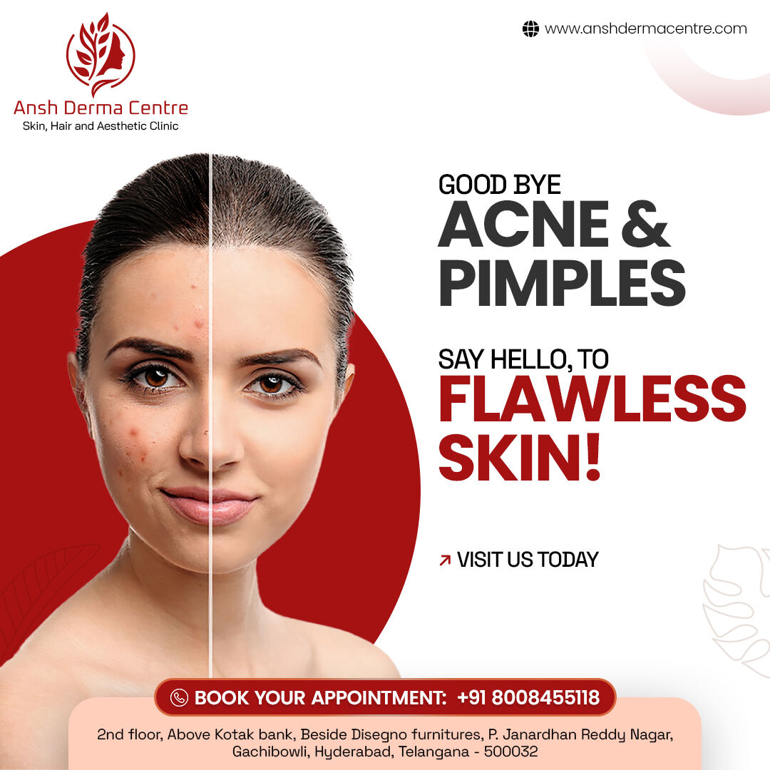 Hyderabad, Health, Skin Doctors In Gachibowli