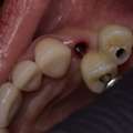 Count On The Best Dentist In Mexico To Get Your Ideal Smile