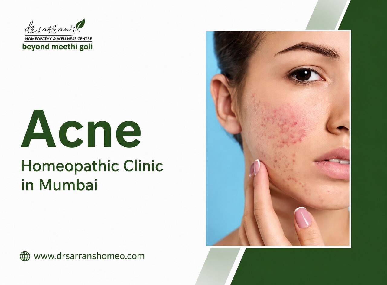 Mumbai, Health, Effective Natural Acne Treatment Homeopathy In Mumbai Care