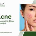 Effective Natural Acne Treatment Homeopathy In Mumbai Care