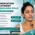 INR 1499,  Pigmentation Treatment In Banjara Hills