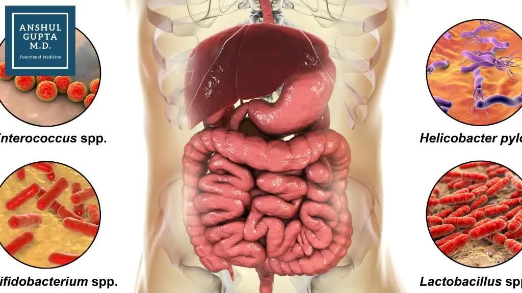 Washington DC, Health, Advanced SIBO Treatment Plan | Eliminate SIBO Permanently | Dr Anshul Gupta