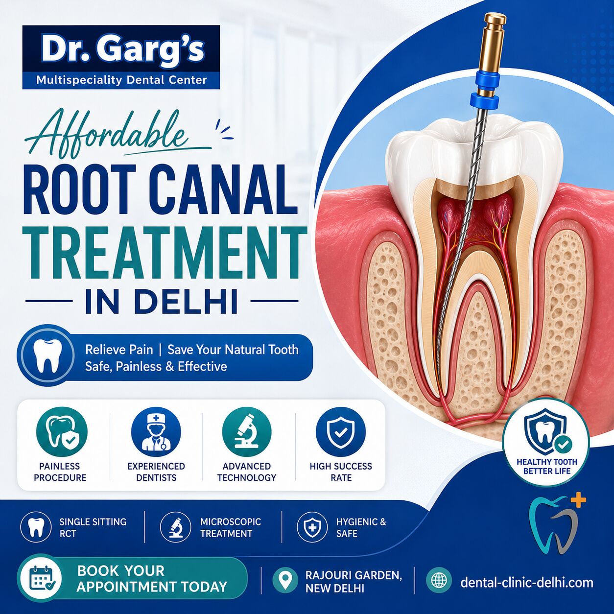 New Delhi, Dental, Affordable RCT Treatment Cost In Delhi | Dr. Garg&rsquo;s Multispeciality Dental Center