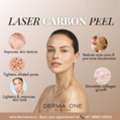 Carbon Laser Peel Benefits Derma One Clinic - Visakhpatnam
