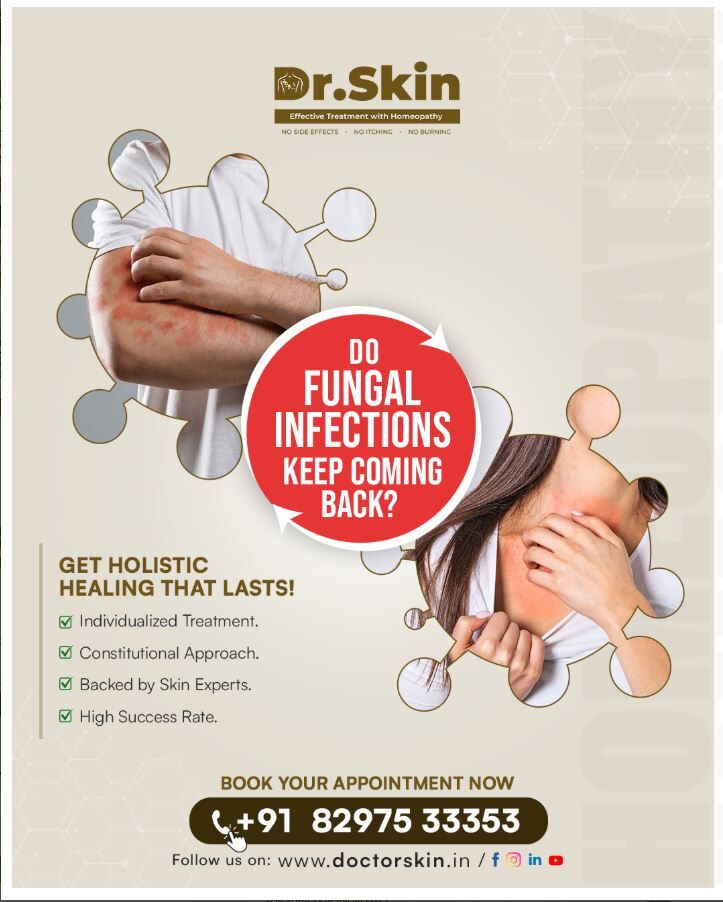 Hyderabad, Health, Skin Fungal Infection Treatment | Expert Homeopathic Skin Care In Hyderabad