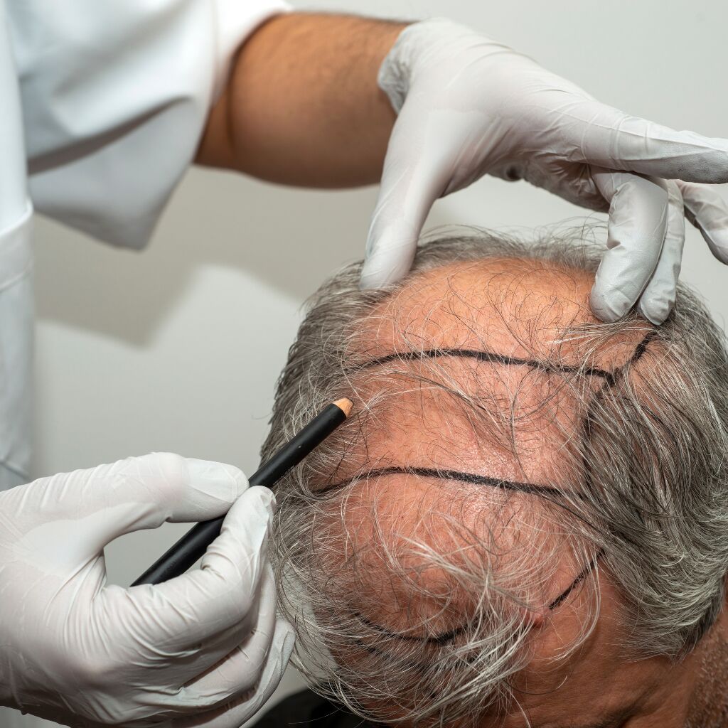 Toulouse, Business, Retrouvez Vos Cheveux Avec Un Expert &Agrave; Toulouse