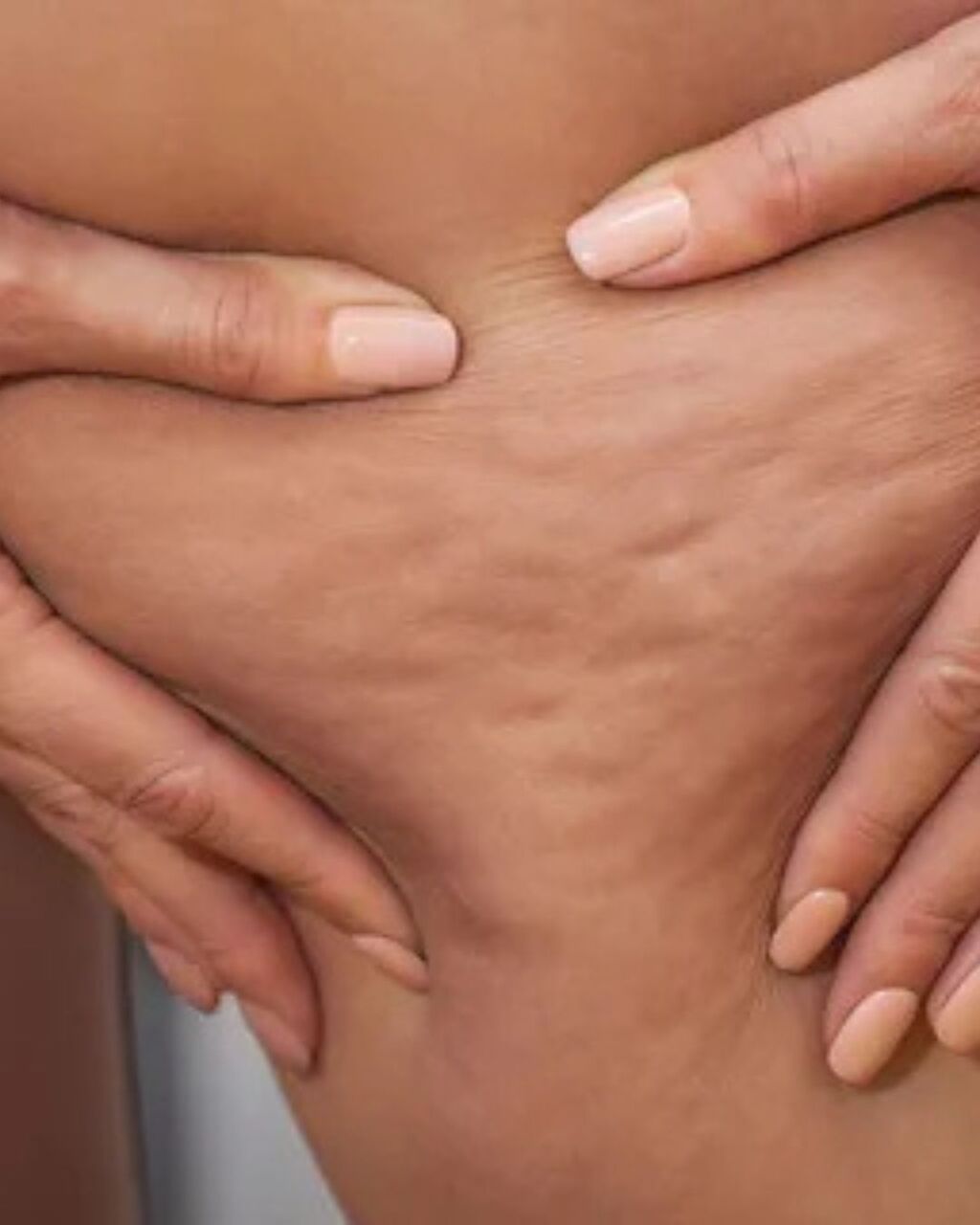 New York, Business, Cellulite Reduction