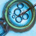 IVF Treatment Cost In Delhi - Dr Rhythm Gupta