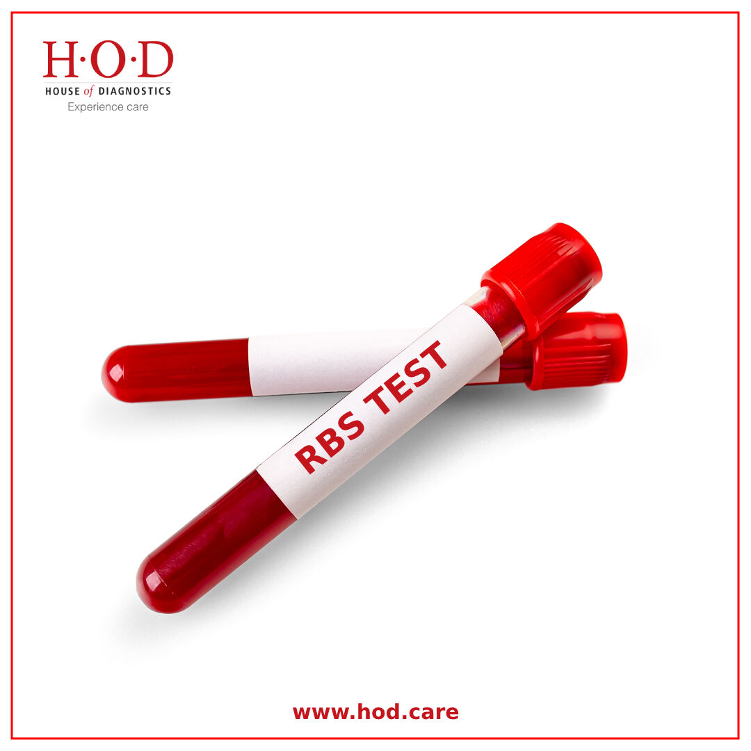 New Delhi, Health & Beauty Items, INR 49,  RBS Blood Test For Diabetes Screening And Monitoring