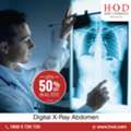 INR 249,  Digital X-Ray Abdomen (Erect & Supine): What To Expect
