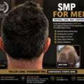 SMP For Men | Natural Scalp Micropigmentation Solutions