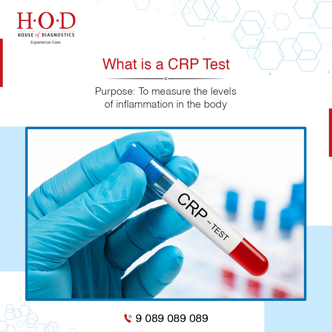 New Delhi, Health & Beauty Items, INR 299,  C-Reactive Protein (CRP) Blood Test For Inflammation Assessment