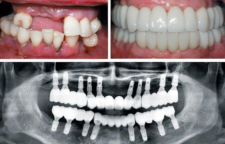 New York, Business Partners, Align Dental Care