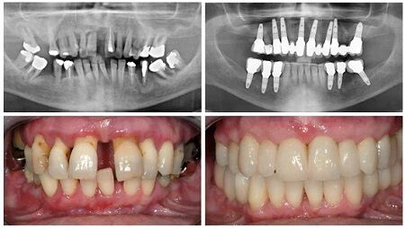 New York, Business Partners, Align Dental Care