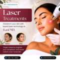 Laser Treatments For Melasma Treatment