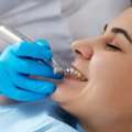 Professional Dental Cleaning In Brampton | Sharing Smiles Dental Care