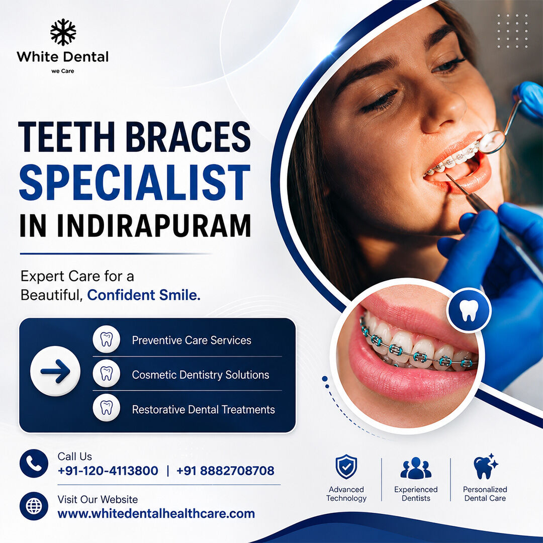 Mumbai, Dental, Teeth Braces Specialist In Indirapuram For Perfect Smiles