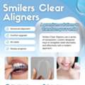 How Long Do Smilers Clear Aligners Take To Straighten Teeth?