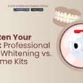 Professional Teeth Whitening Vs. At-Home Kits — AFFORD Clinic